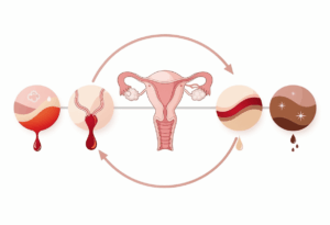 Pourquoi les pertes sont-elles marron